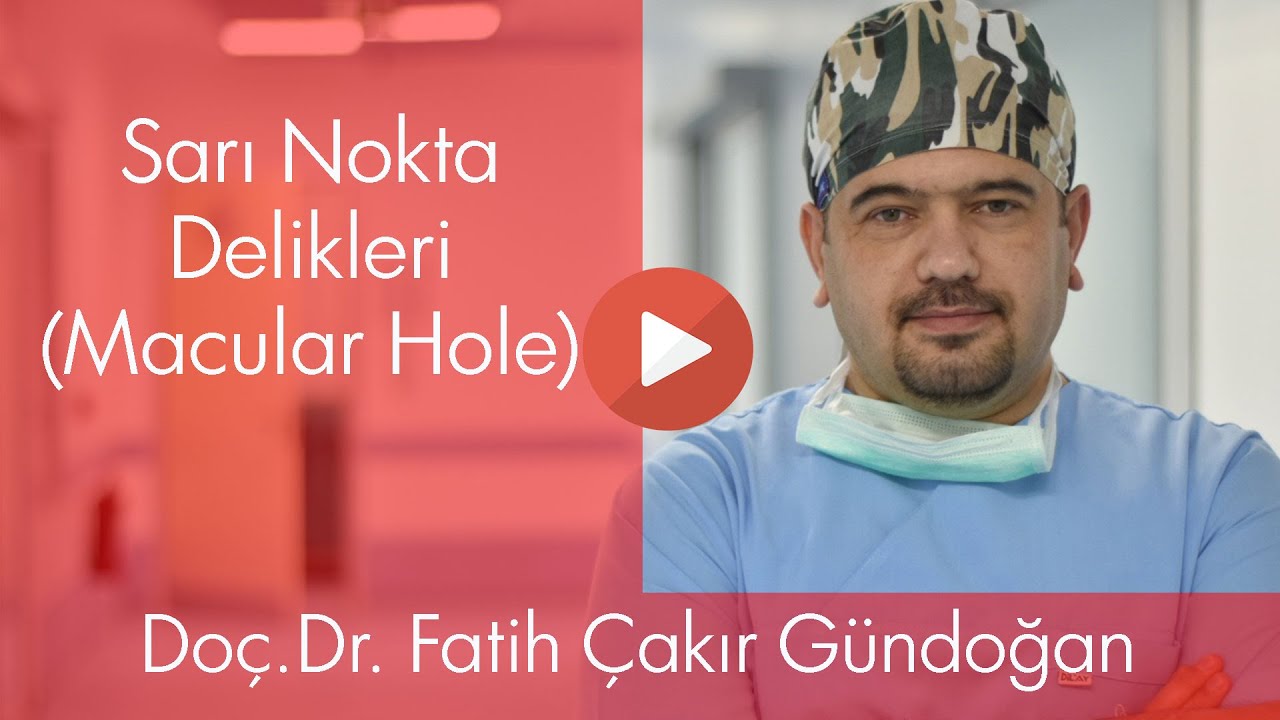 Sarı Nokta Delikleri (Macular Hole)