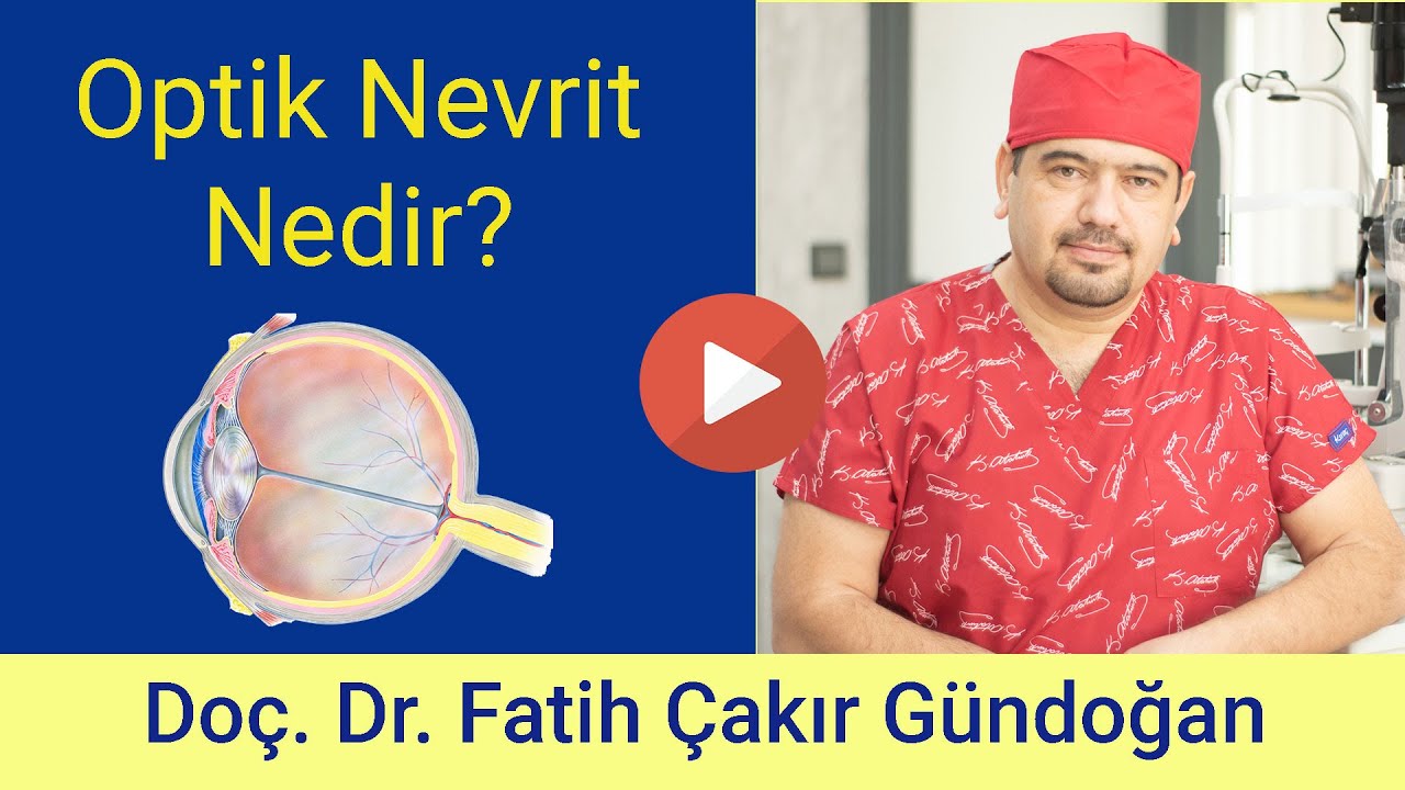 Optik Nevrit Nedir? Nedenleri Nelerdir?