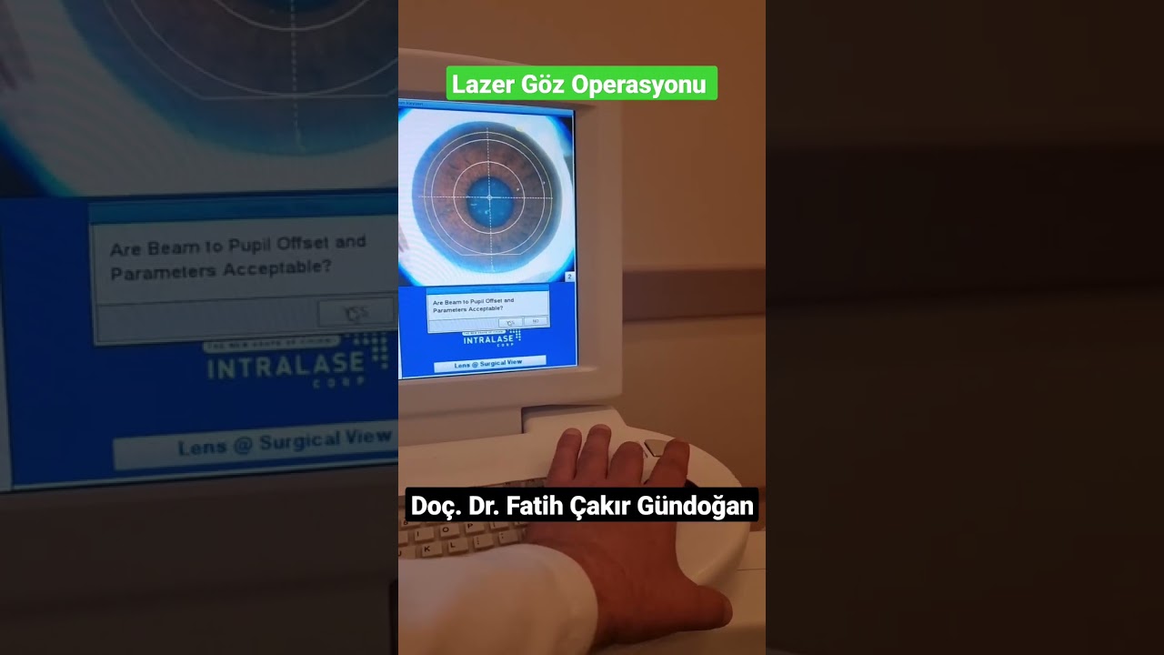 Lazer Göz Operasyonu-LASİK