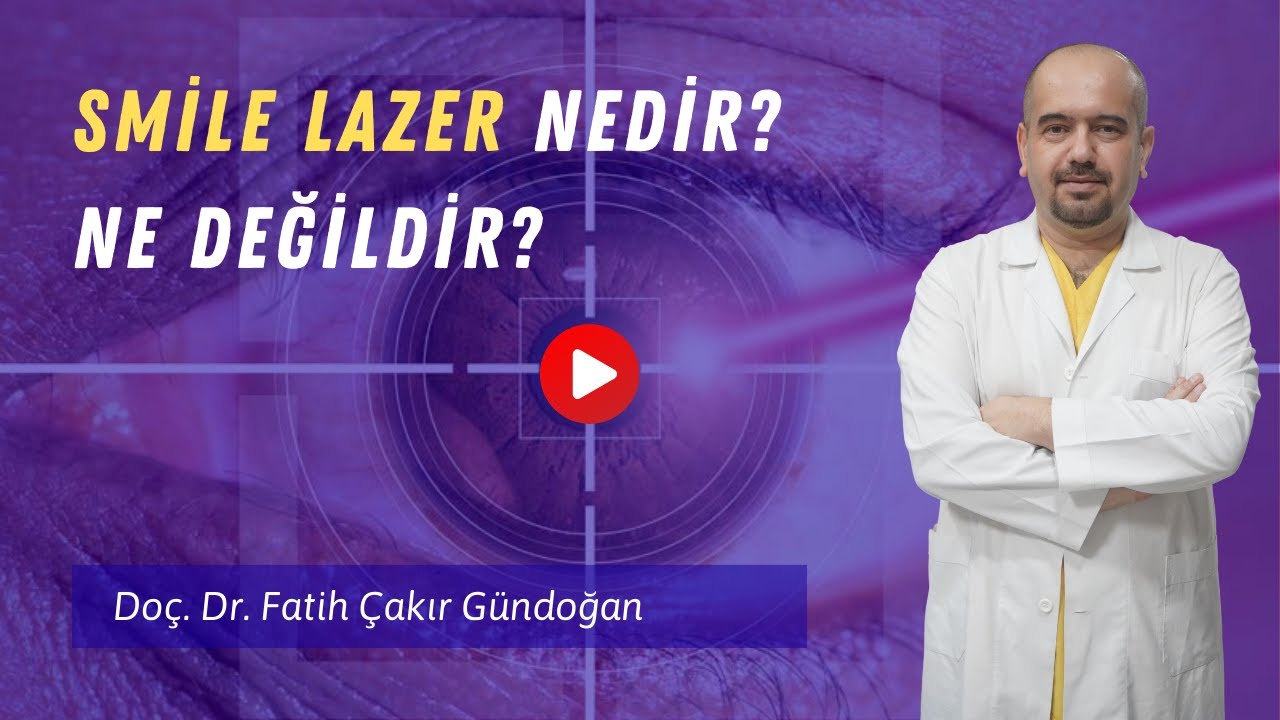 Smile Lazer Nedir?